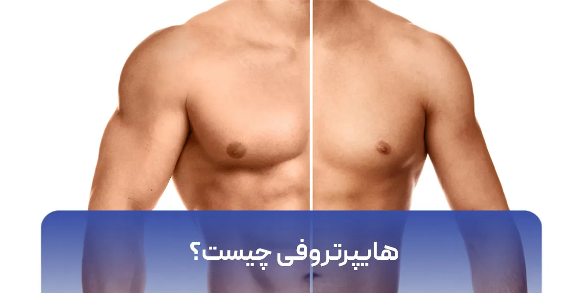 هایپرتروفی چیست؟